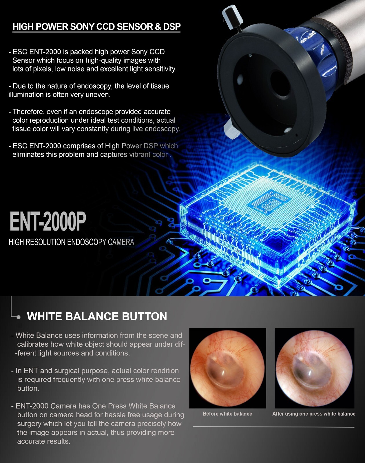 Endoscopy camera HD Portable USB Rigid Endoscope Storz ENT Medical 1.2MP Windows