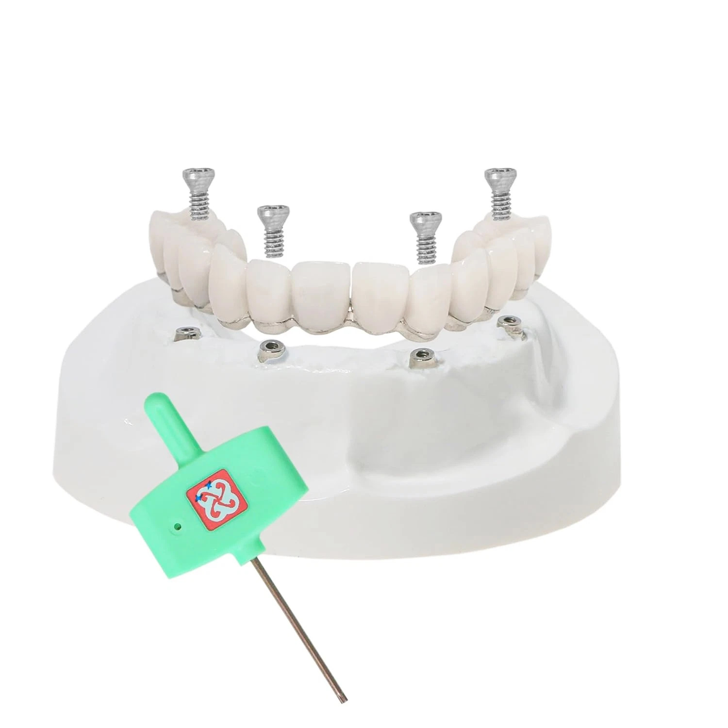 Dental All-on-4 Overdenture Model Dental Upper Jaw Implants Restoration 4 Screws