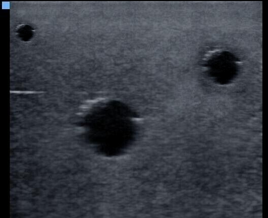 ultrasound vascular access phantom training model-FLUID FREE