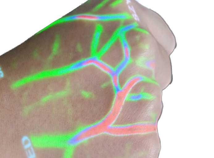 Infrared Vein Finder Vascular Color Imaging Wireless Viewer with Depth Detection