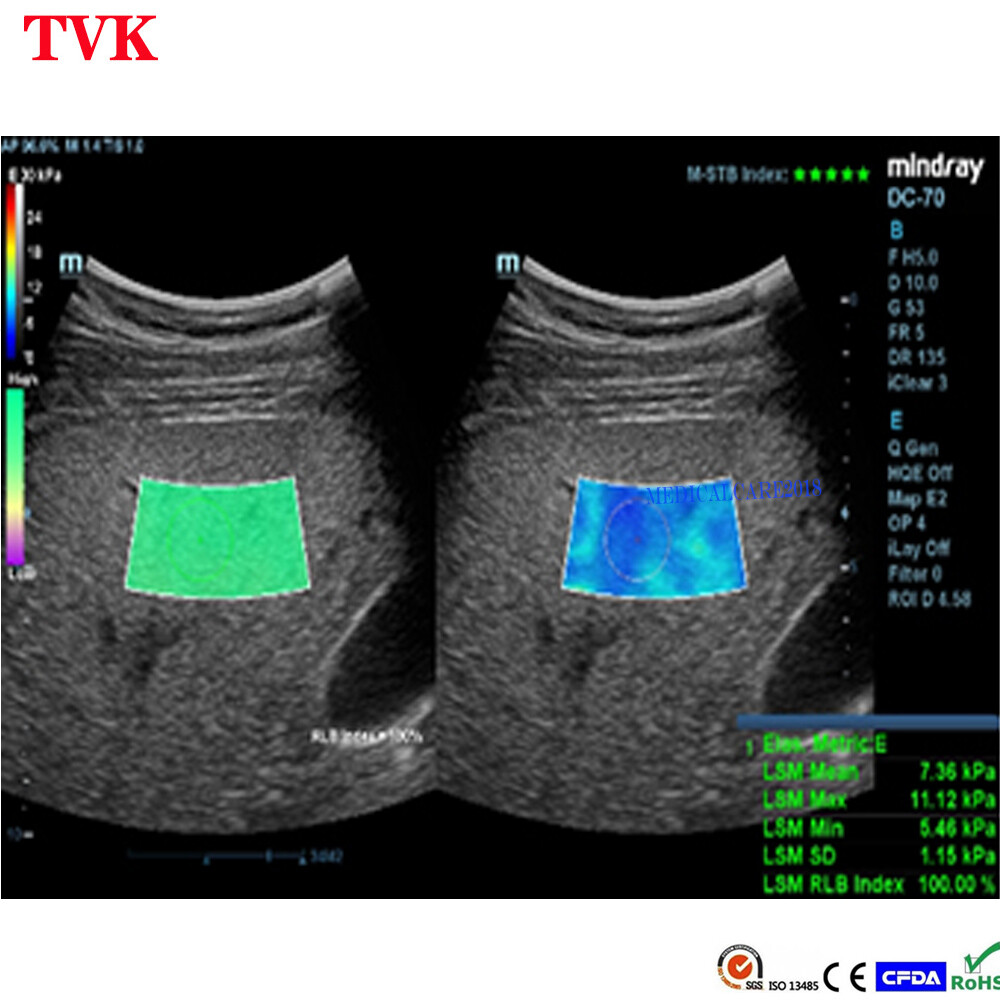 Mindray C5-2E Convex Array probe For DC-70, DC-70Exp,DC-8, Compatible Transducer