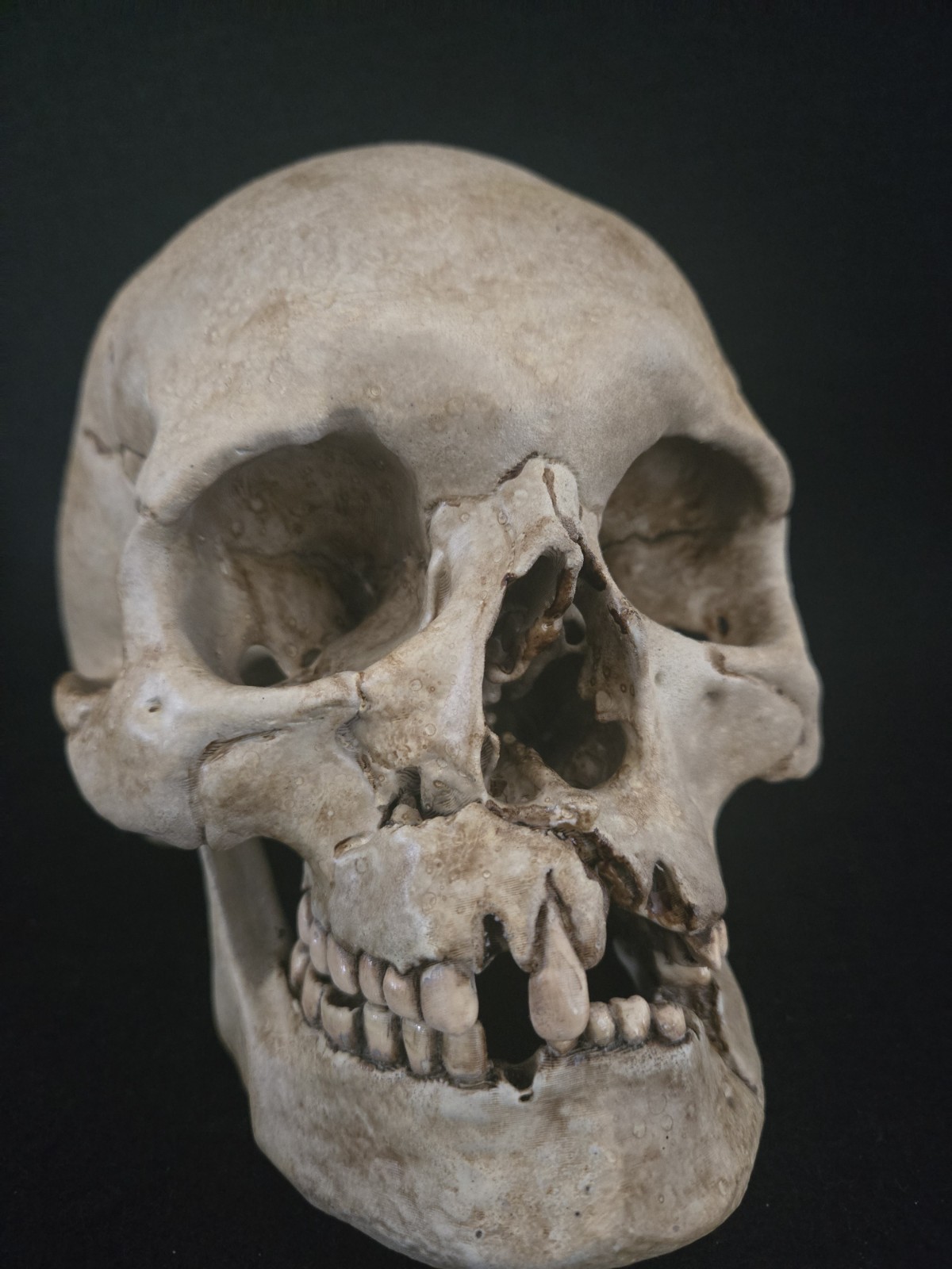 Human Skull Life Size Replica with battle wounds Realistic - Momento Mori