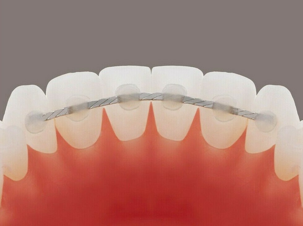 Dead Soft Flat Ortho Lingual Retainer Wire - 60" - Spool/ Roll/ Strips