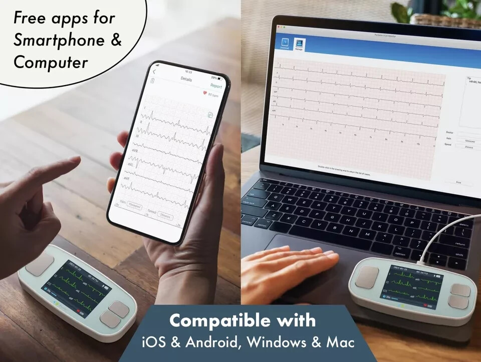 EMAY 6Leads Portable ECG Monitor Record ECG & Heart Rate in 6 Channels /OPEN BOX