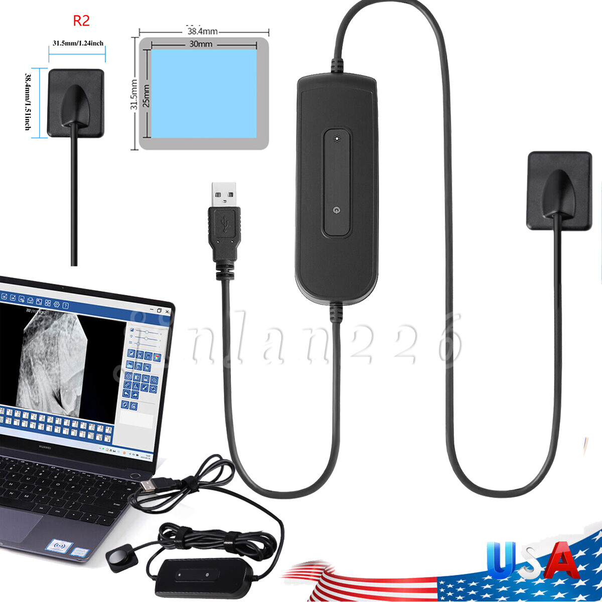 Rayos X Handheld Dental Intraoral Ray System w/ Case #2