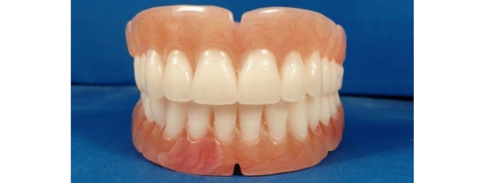 Dentures, set of false teeth with Hollywood bleach shade teeth