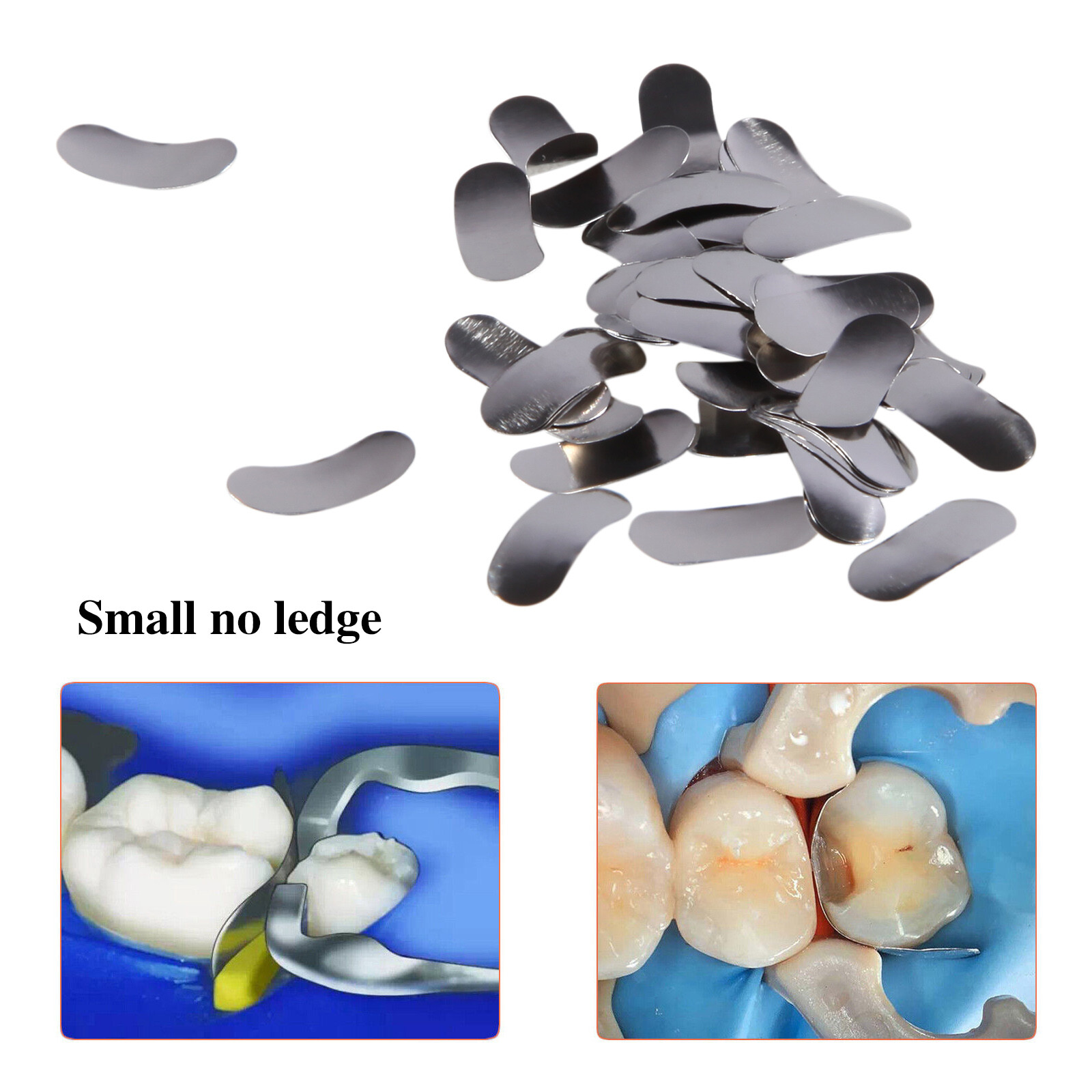 Dental Metal Matrices Matrix Band Sectional Contoured Refill S/M/L 50Pcs/1Pack