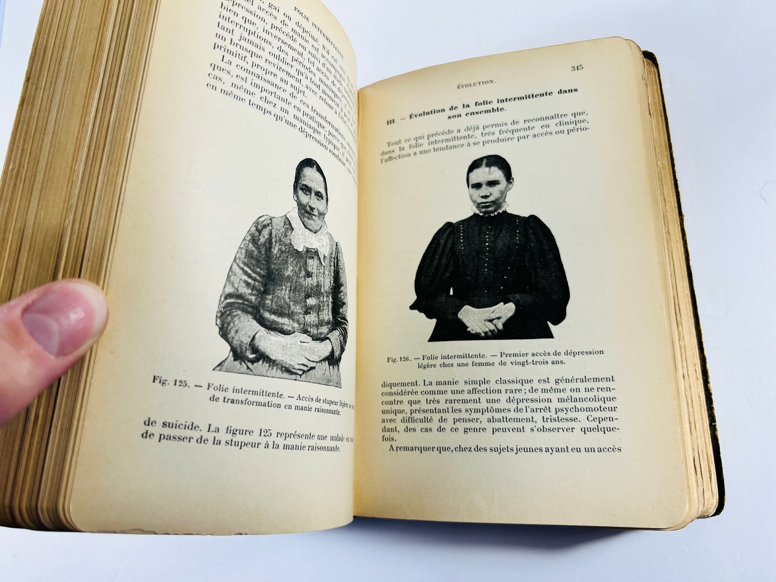 RARE 1904 Manual of Psychiatry ODDITY Medical Book AMAZING weygandt