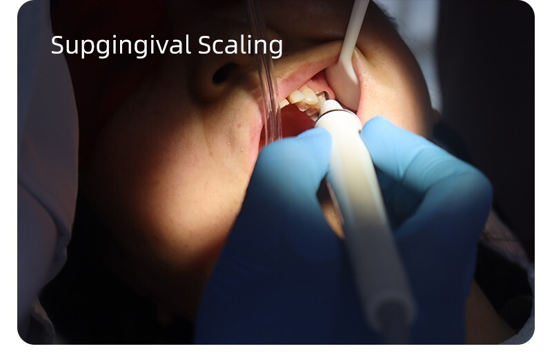 Dental Ultrasonic Piezo Scaler 2 Bottles Fits EMS Cavitron Woodpecker Handpiece