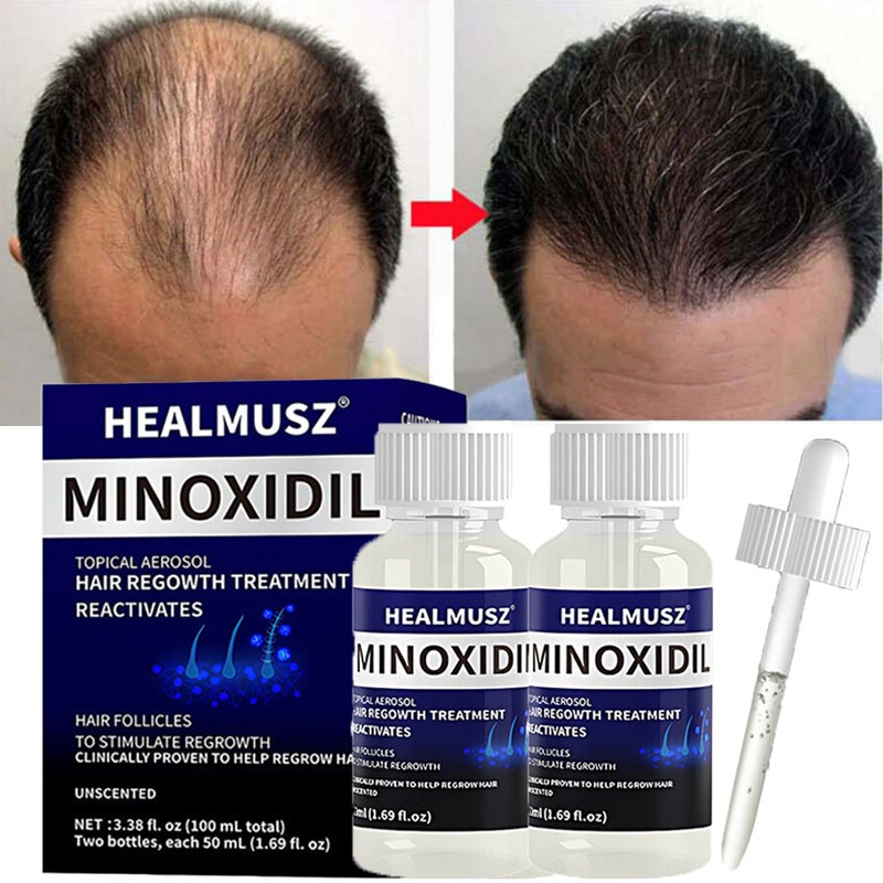 2 Pack Minoxidil 5% Extra Strength Men Hair Regrowth Treatment 2 Month Supply