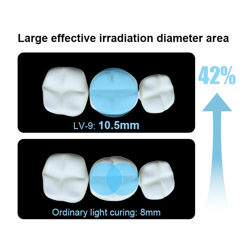 Wireless Dental LED Curing Light 1 Second Cure High Power Blue Lamp Curing Resin