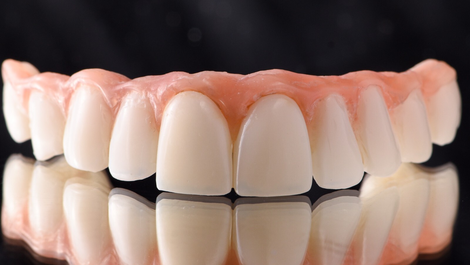 DLP SLA LCD 3d printer ALL ON X resin - for all on x cases, bridges,arcs, hybrid