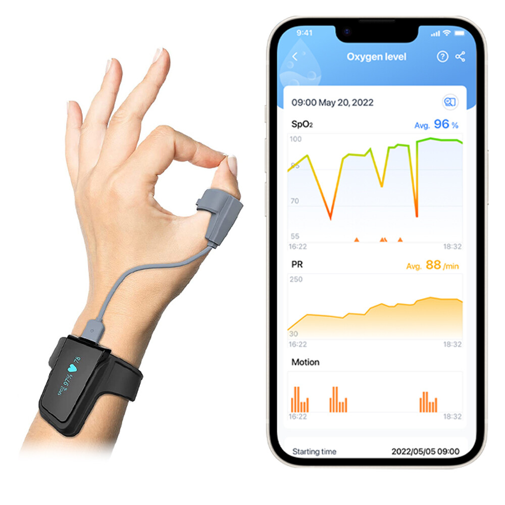 Wellue Pulse Oximeter O2 Sensor Ring for Checkme O2 Max, SleepU and Visual Oxy