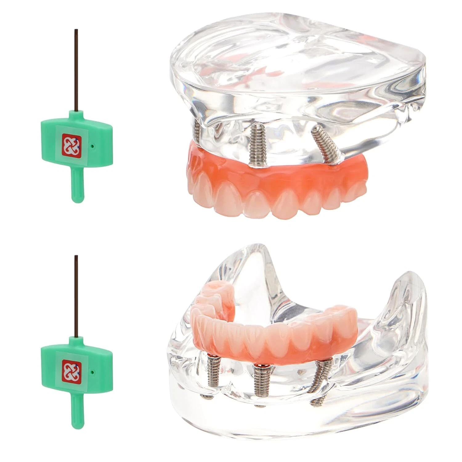 US Dental All-on-4 Overdenture Implant Model, Upper/Lower Jaw-Clear,With 4 Screw