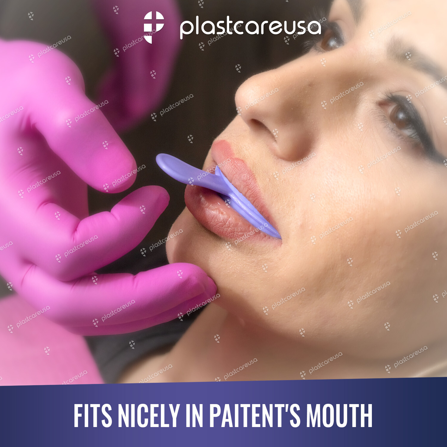 35 Anterior Dental Bite Registration Impression Trays, Mold Alginate Teeth 1 Box