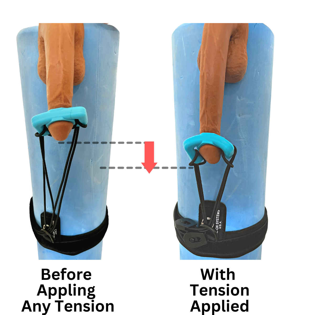 Penis Stretcher Extender - Male Enhancement Penis Stretching Device