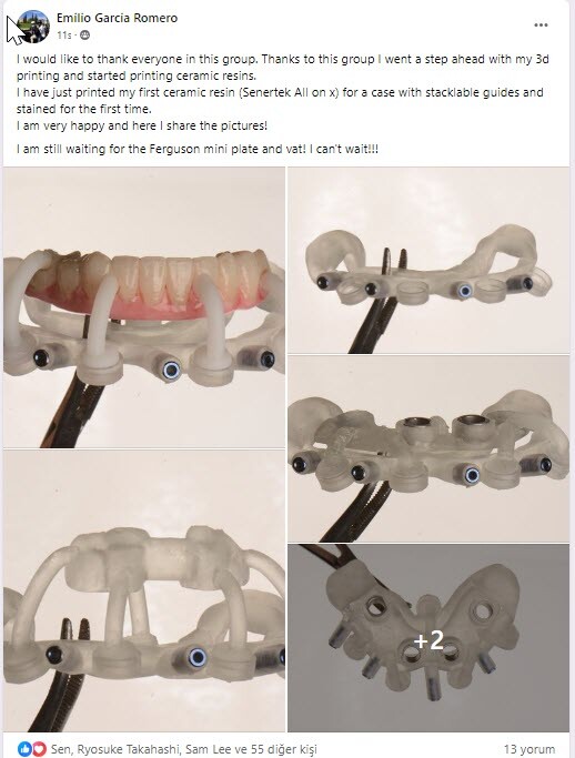 DLP SLA LCD 3d printer ALL ON X resin - for all on x cases, bridges,arcs, hybrid