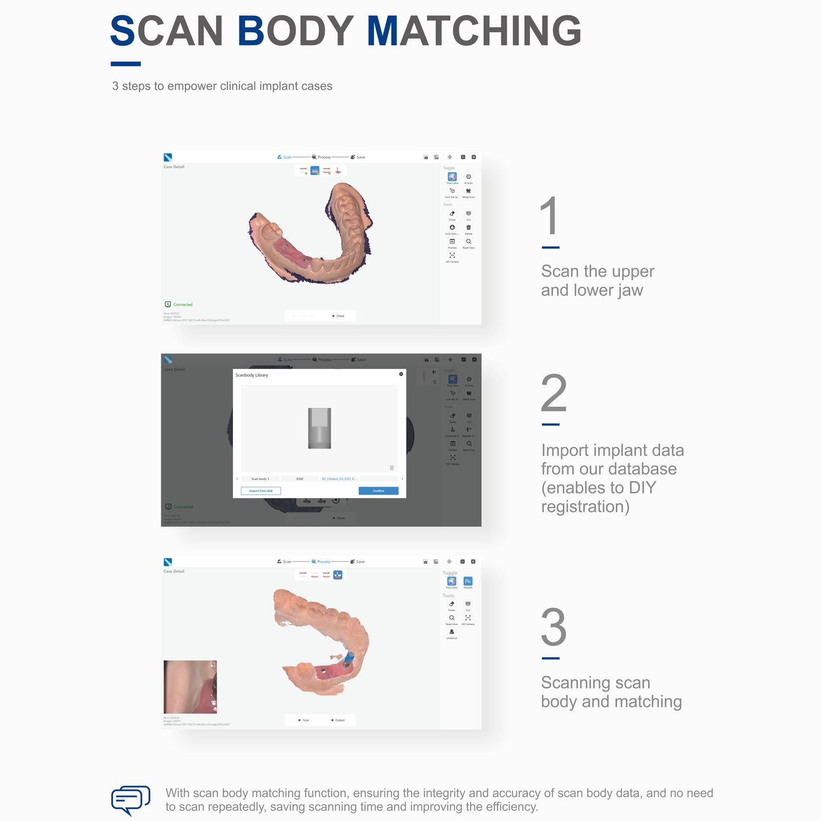 Dental Digital Intraoral Scanner Scanning Dentistry 3D Printing & Software USA