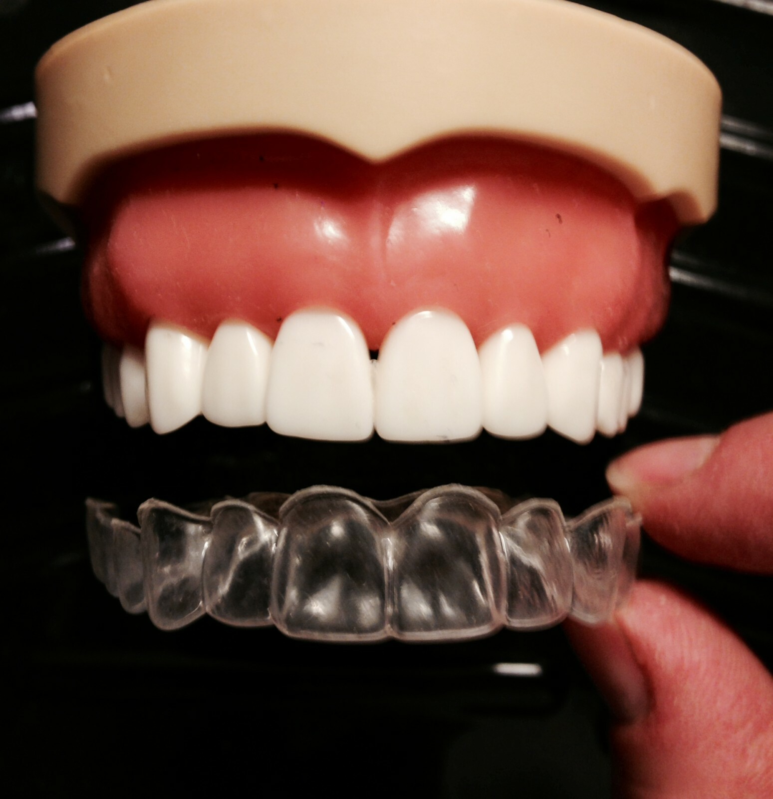 Premium Dental Retainer ~Custom Fitted ~Made by USA Dental Lab