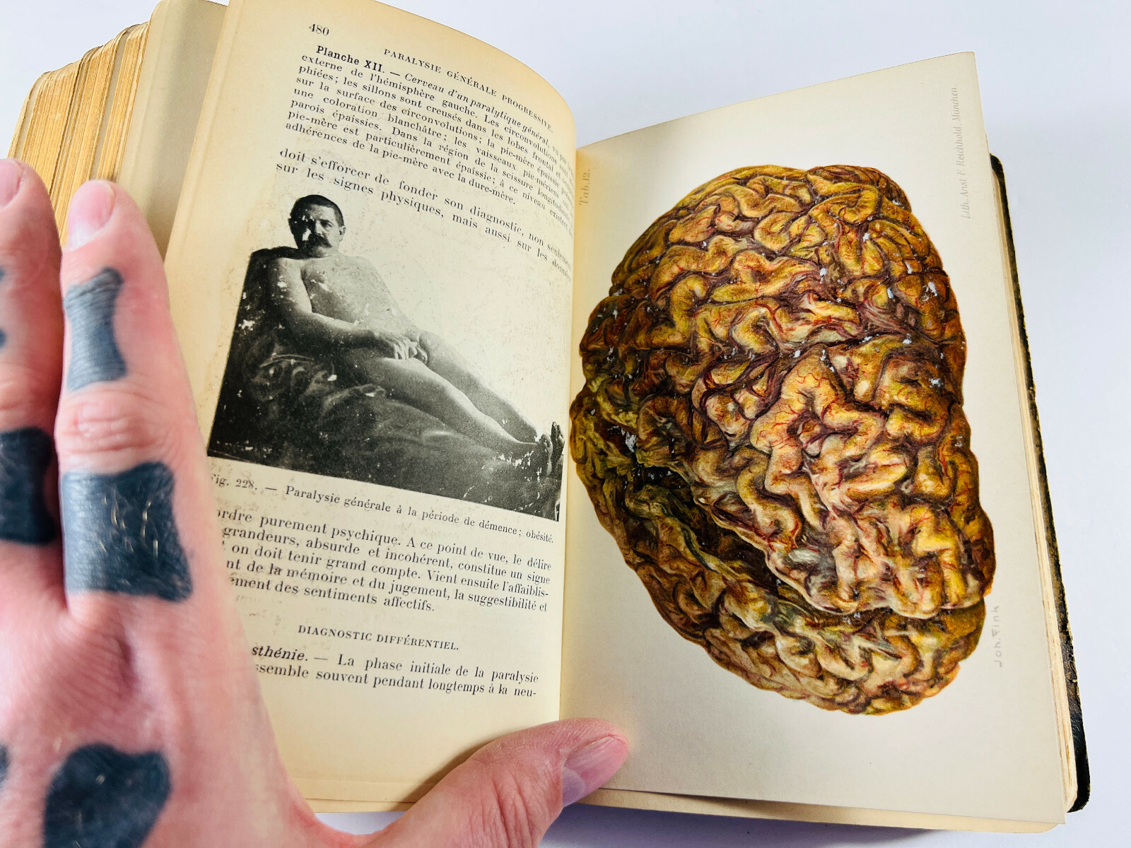 RARE 1904 Manual of Psychiatry ODDITY Medical Book AMAZING weygandt