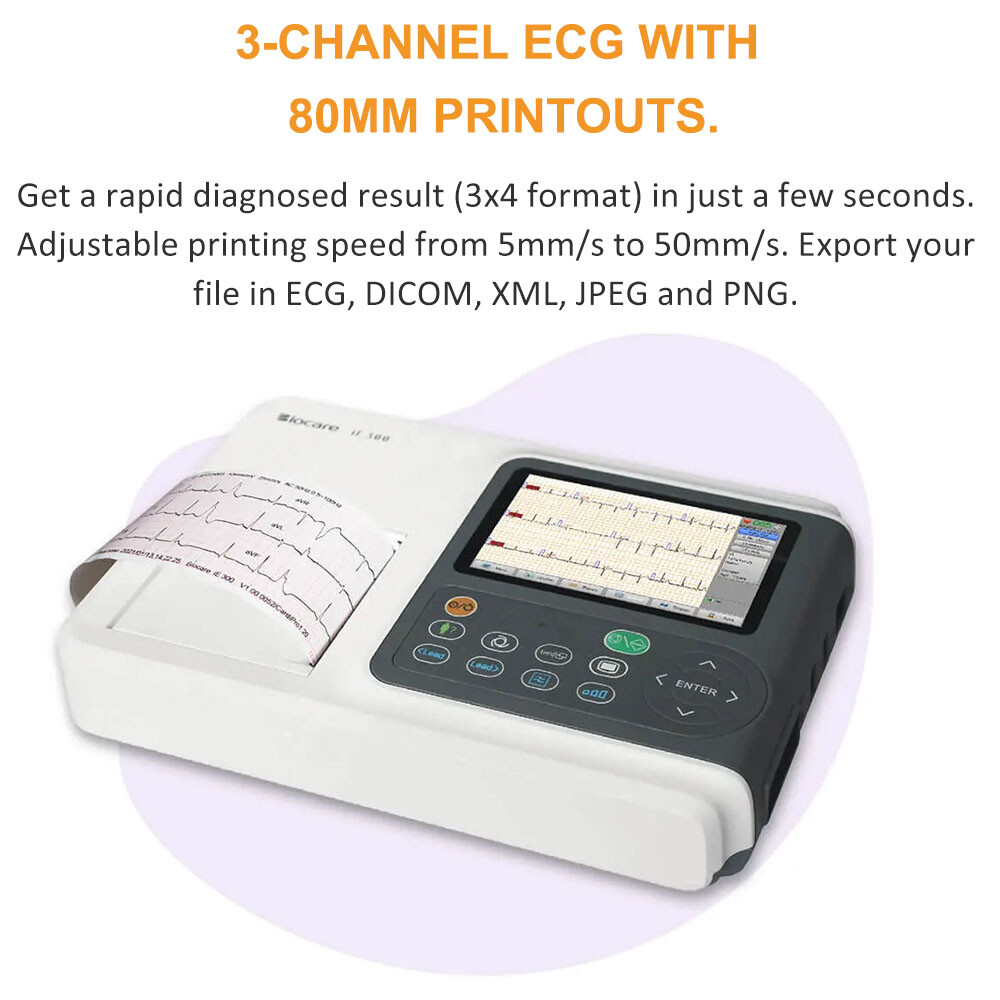 12 lead ECG Machine with printer Diagnosis Auto-analysed Result FDA Approved