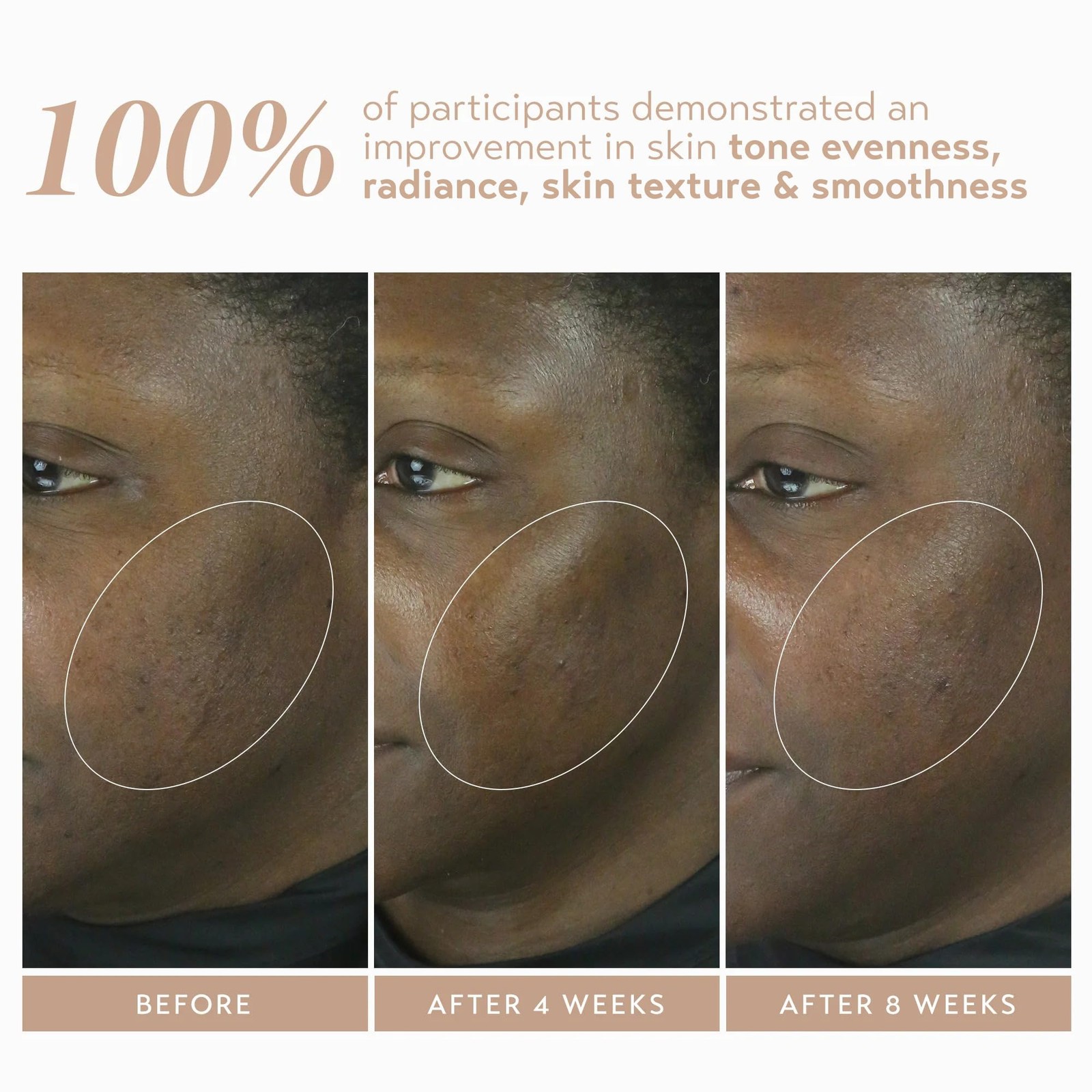 SHANI DARDEN SKIN CARE Retinol Reform with 1% Encapsulated Retinol Serum for Fac