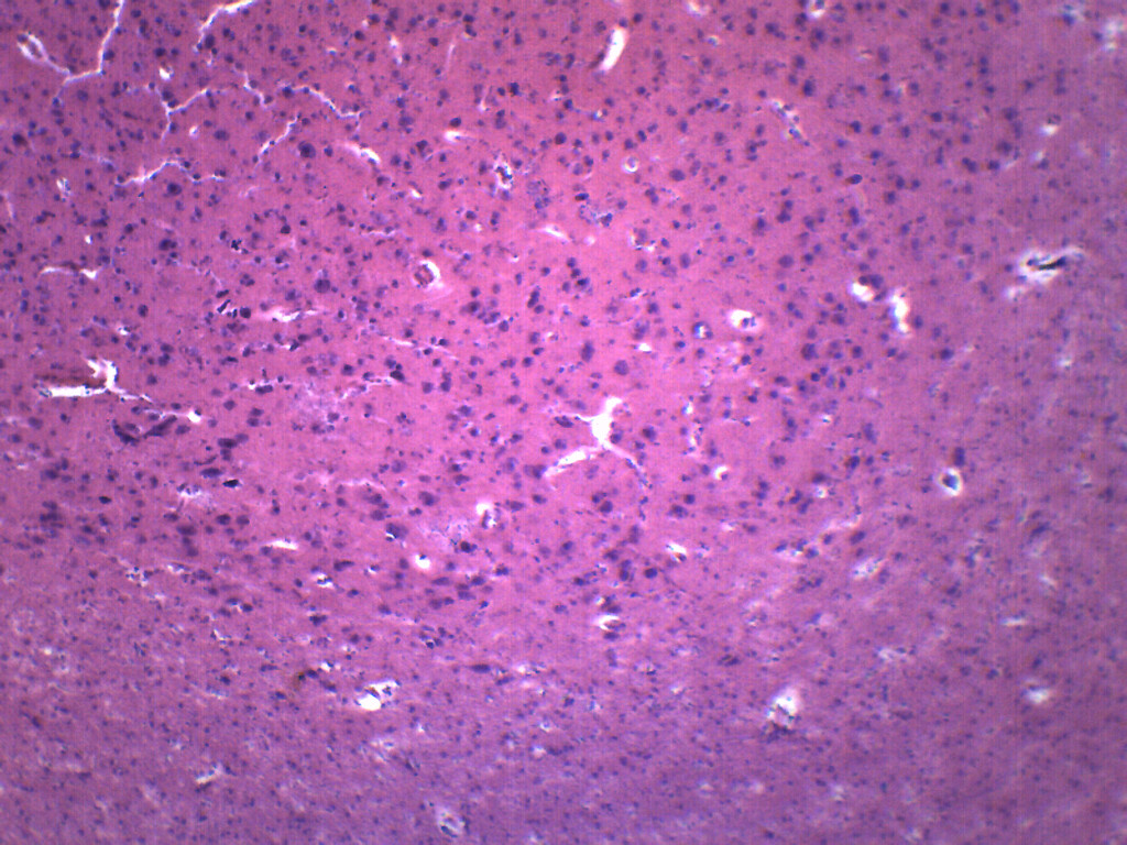 Brain Section - Prepared Microscope Slide - 75x25mm - Eisco Labs