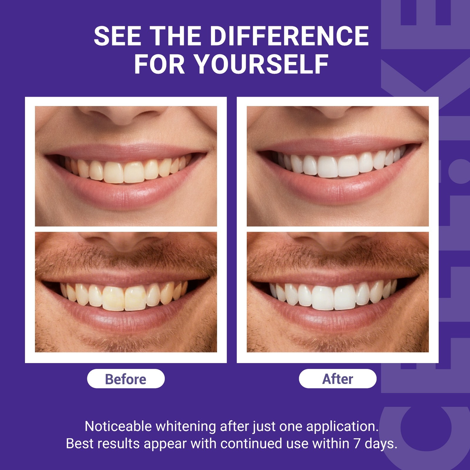 CEELIKE Purple Teeth Whitening Strips, PAP + nHAP, 42 Strips ( 21 Treatment )