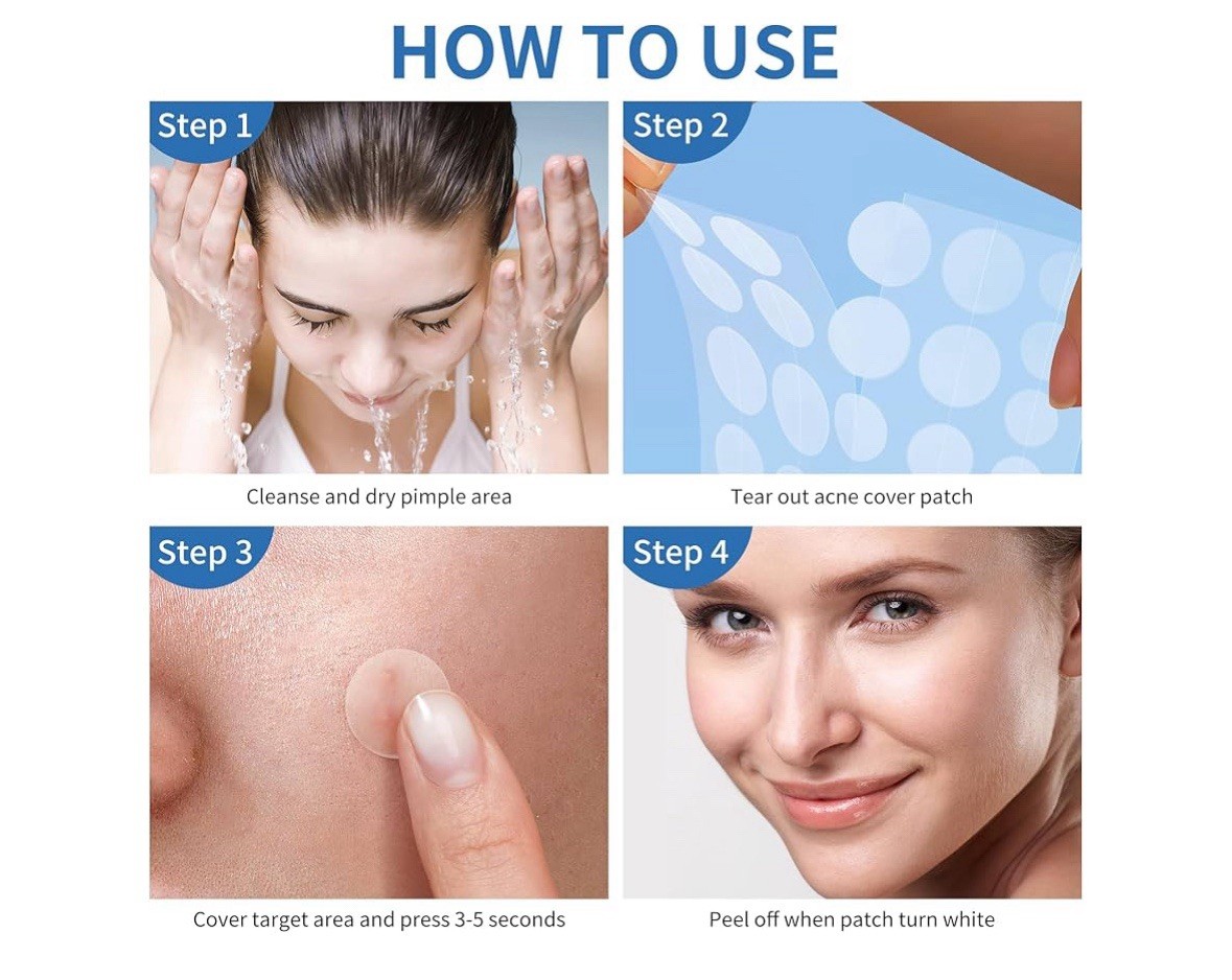 Pimple Patches for Face, 4 Size 300 Counts Acne Patches