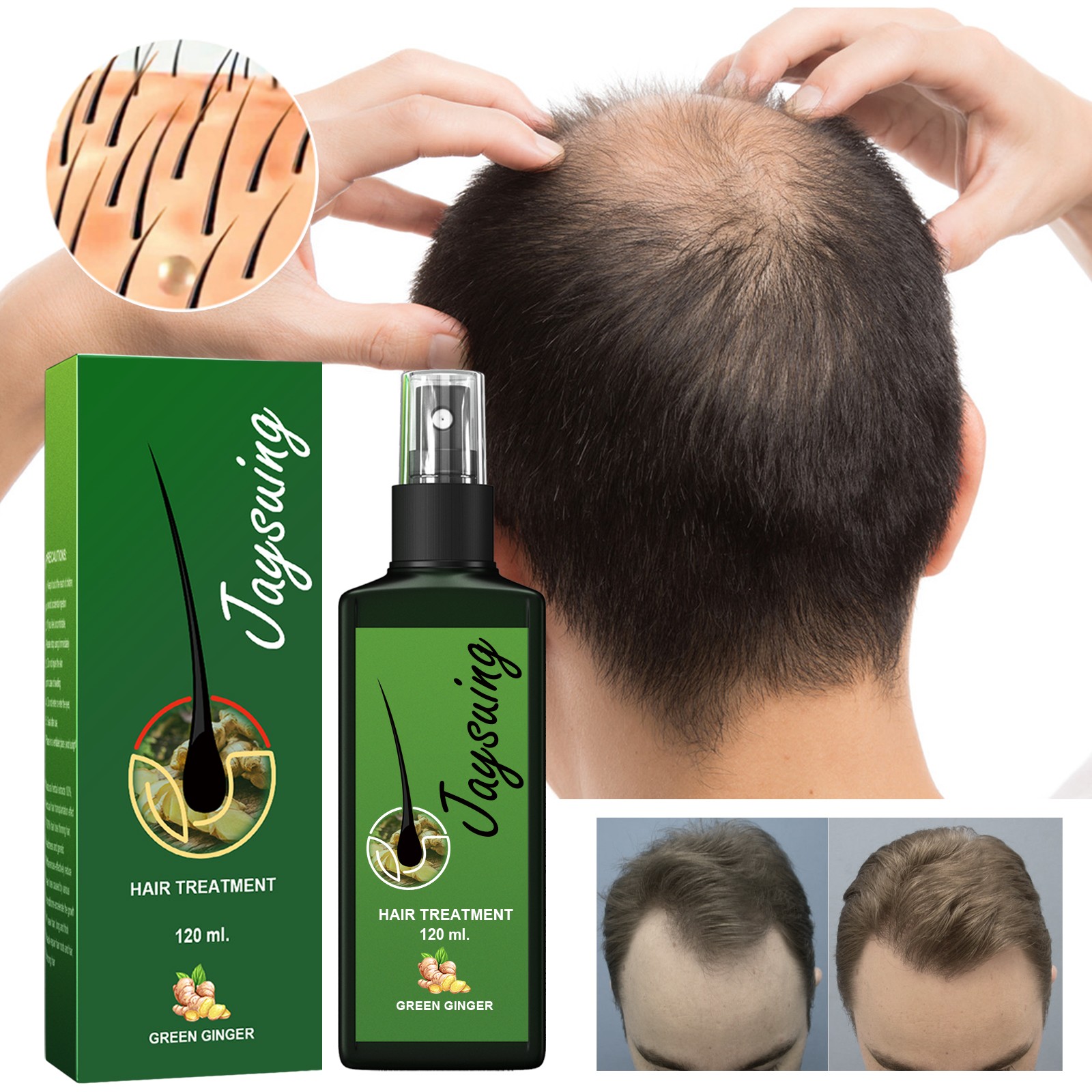 Jaysuing Hair Treatment, Strengthens Hair, Nourishes Root Growth And Thickens Sc