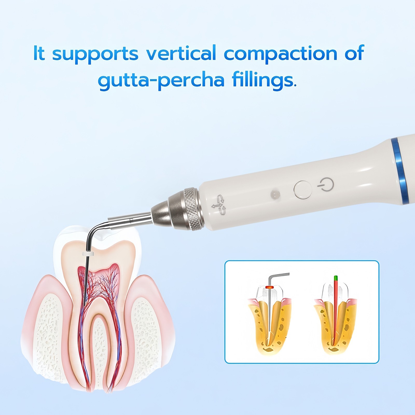 Dental Gutta Percha Obturation System Endo Heated Pen Wireless Eododontic+2 Tips