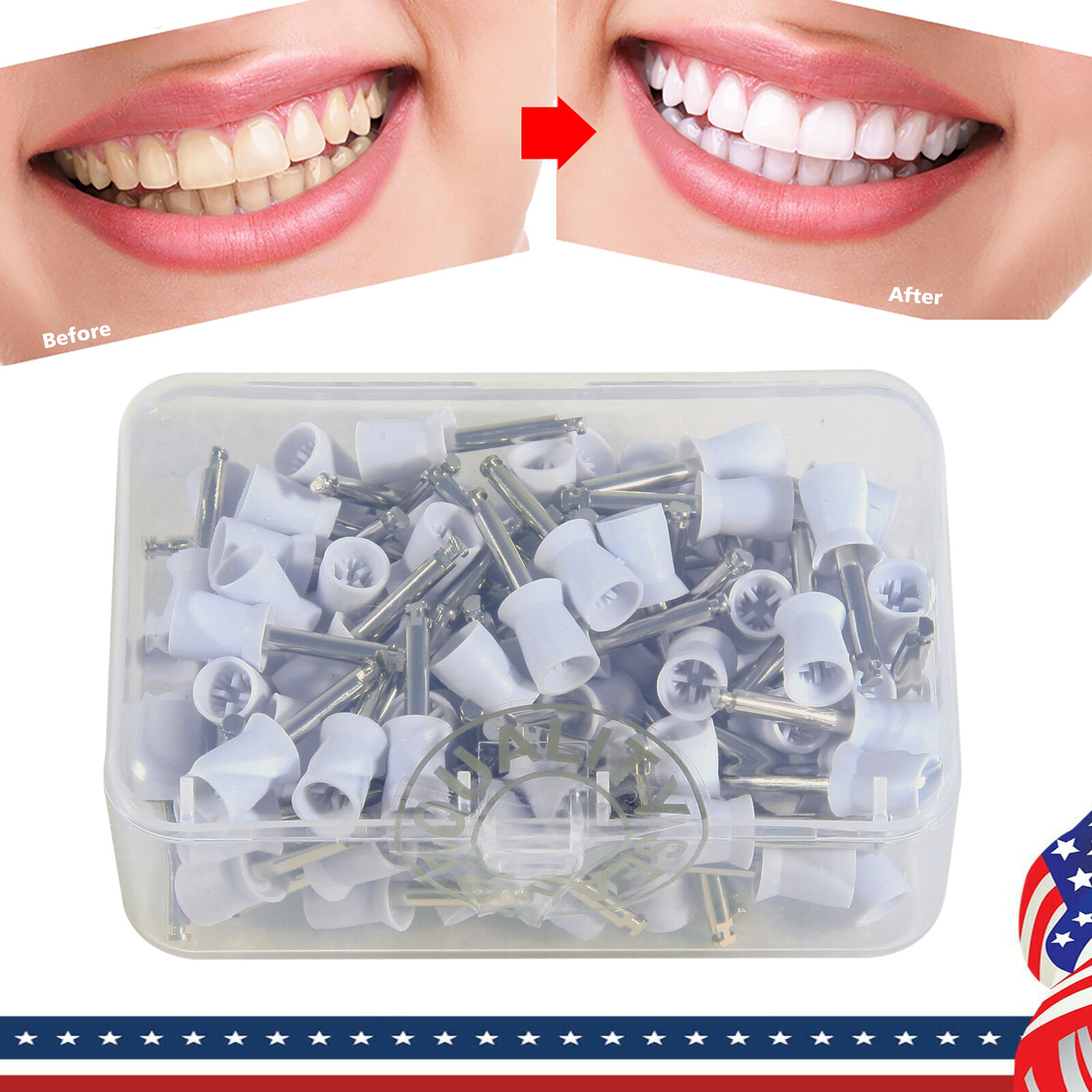 100pcs Dental Polishing Polish Cups Prophy Cup Latch Type Brush Rubber SJ