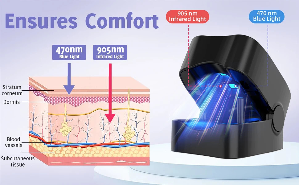 Nail Fungus Treatment Toe Nails Toenail Fungus Remover Toenail Laser Device