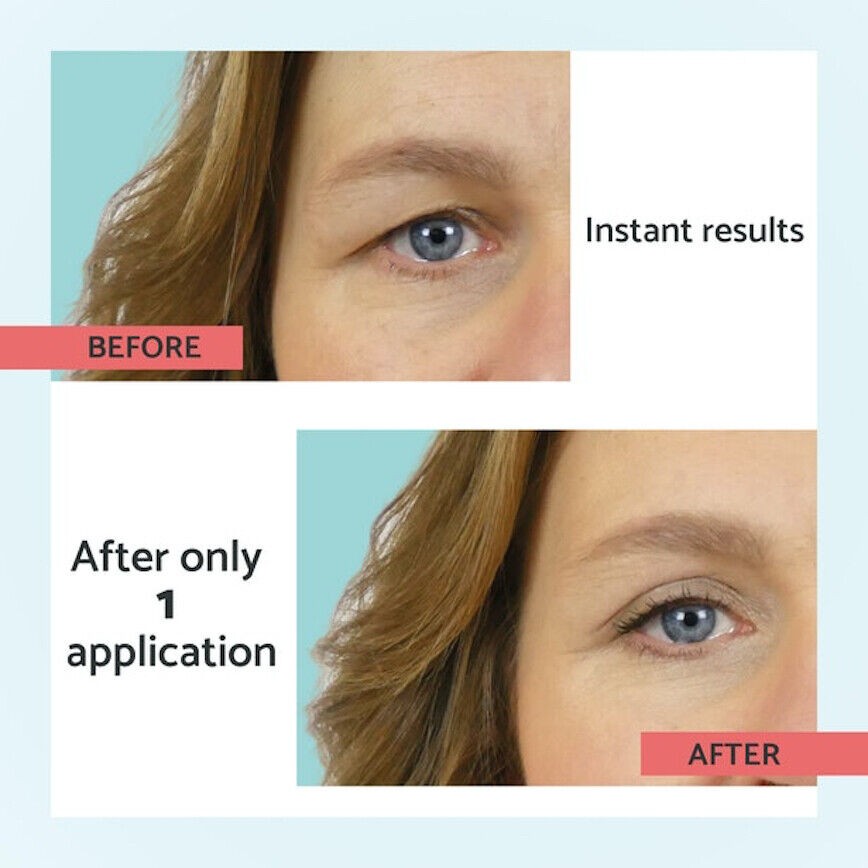 Remescar Sagging Eyelids 8ml
