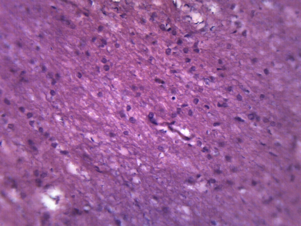 Brain Section - Prepared Microscope Slide - 75x25mm - Eisco Labs