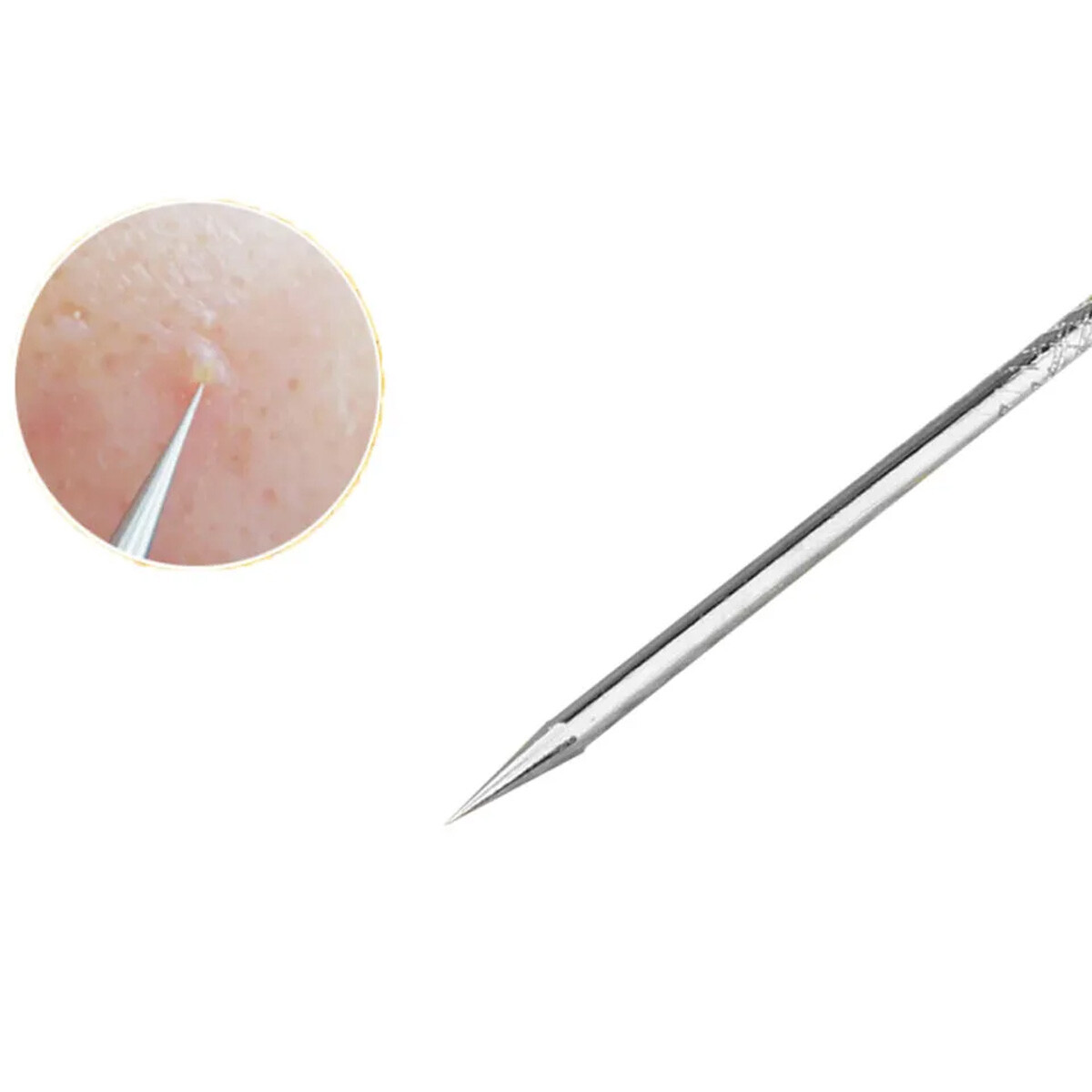 10 Pcs Pimple Popper Blackhead Remover Kit Tools Set Comedone Zit Extractor