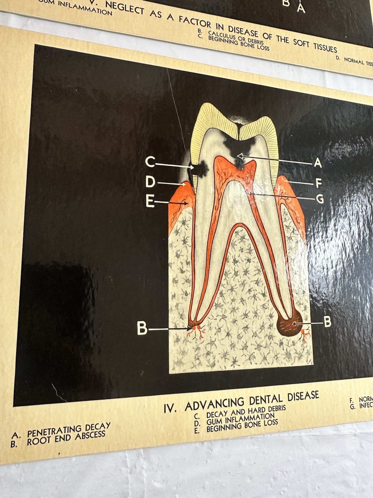 Vintage Lactona Inc Dental Anatomy Diagram Prints 11X8.5 Inches Dentistry