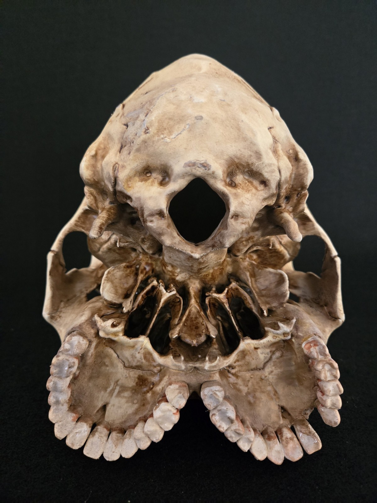 Human Skull - Triclops - Realistic Full Adult Size