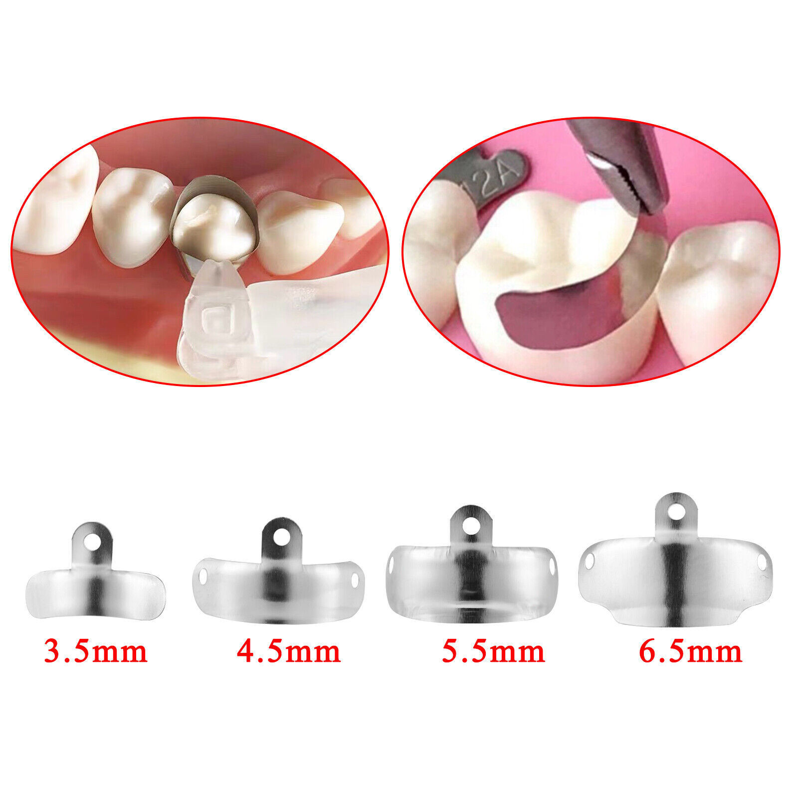 Dental Matrix Bands Ring Sectional Matrice Clamp Fit Garrison Palodent V3 System