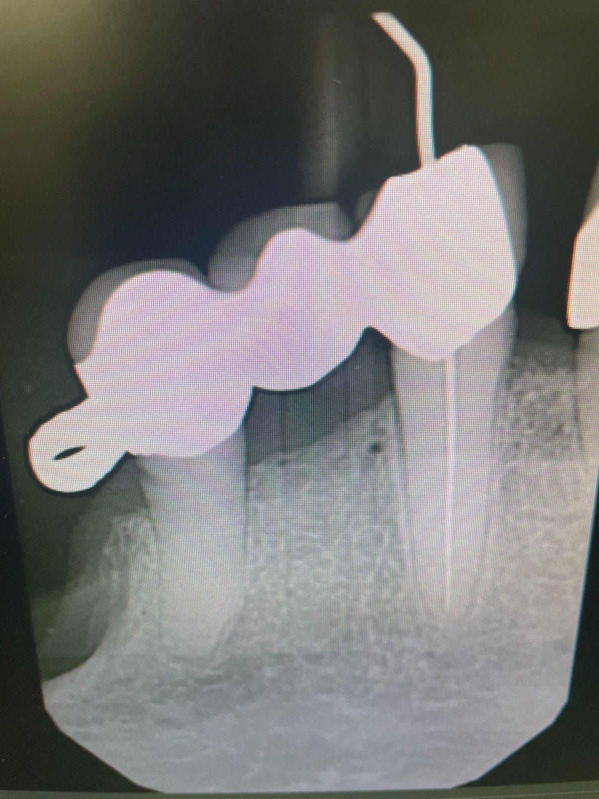 60 pcs Autoclavable - Apical/Bitewing Adult Digital Sensor Positioner-Holder