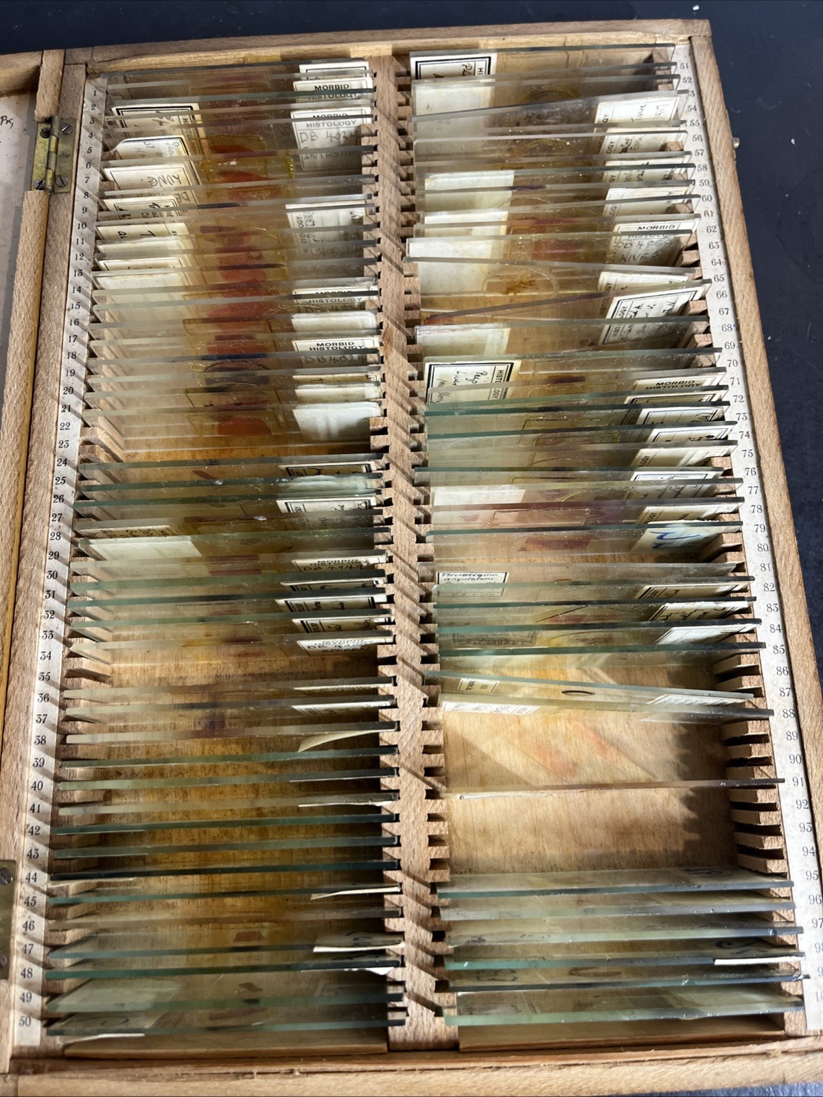 Antique 1936 University of Edinburgh Histology Microscope Slide Set Case 83