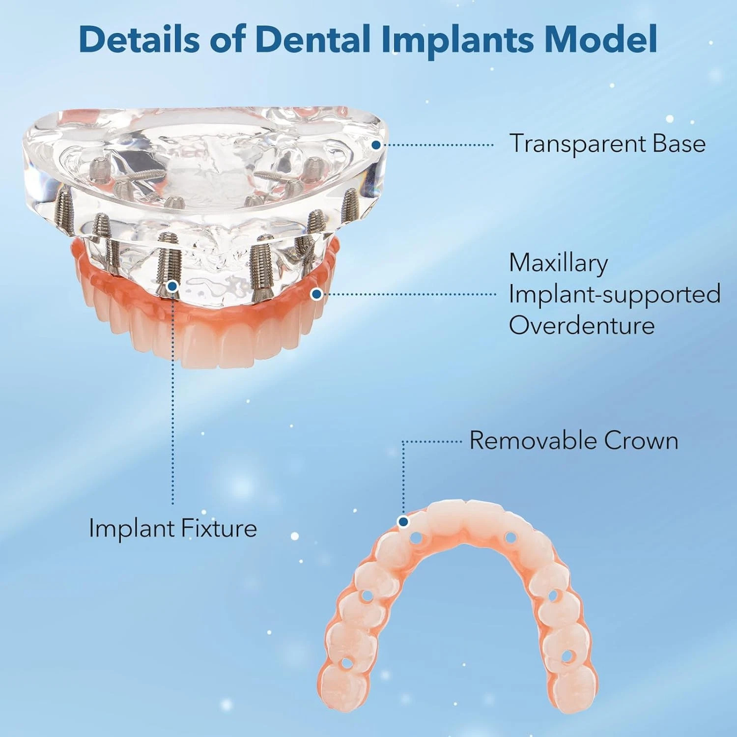 Dental Implant Restoration Model Upper Jaw 6 Screws Post Core Bridges M6001-2 US