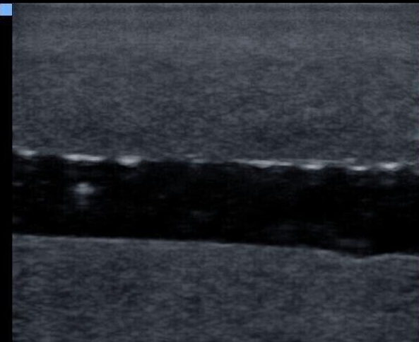 ultrasound vascular access phantom training model-FLUID FREE