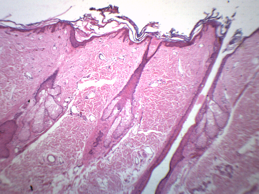 Hair Follicle - Prepared Slide - 75x25mm - Eisco Labs