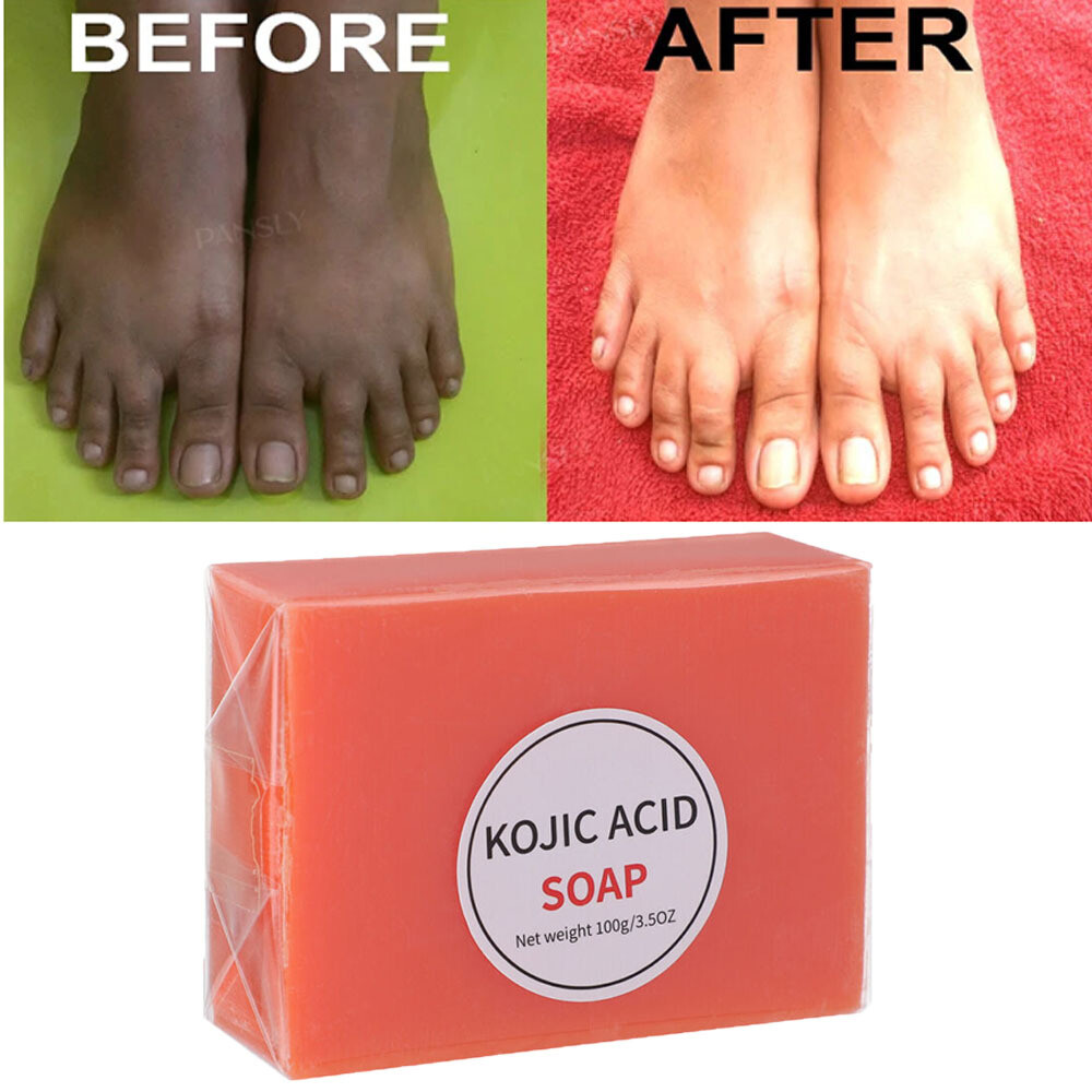 Kojic Acid Soap Dark Skin Whitening Bleaching Lightening Brightening Face & Body
