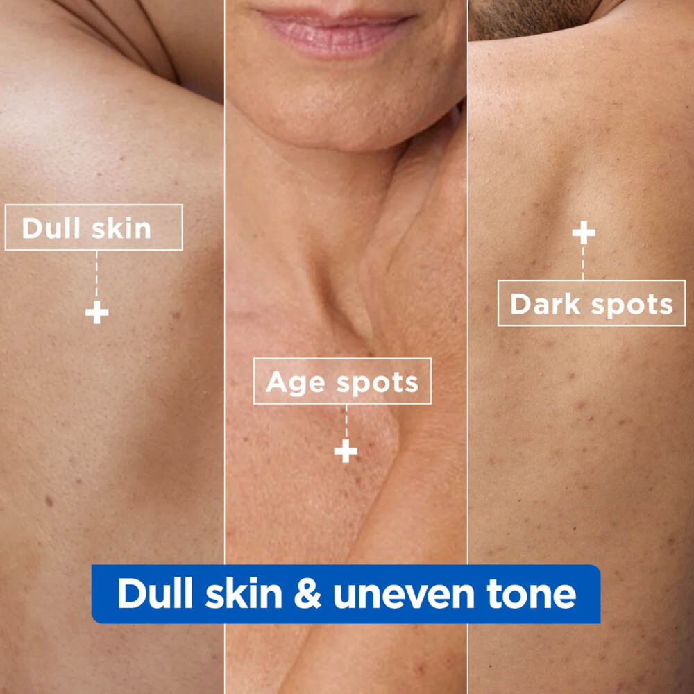 Mixa Niacinamide Bright Moisturizing Anti-Dark Spots Cream with Shea Butter x4