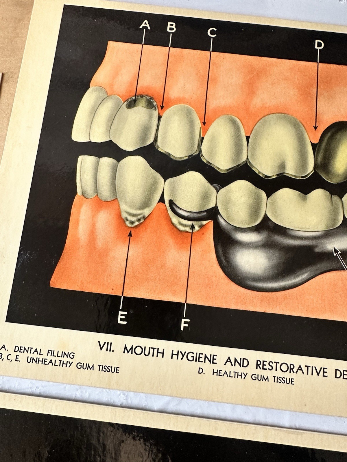 Vintage Lactona Inc Dental Anatomy Diagram Prints 11X8.5 Inches Dentistry