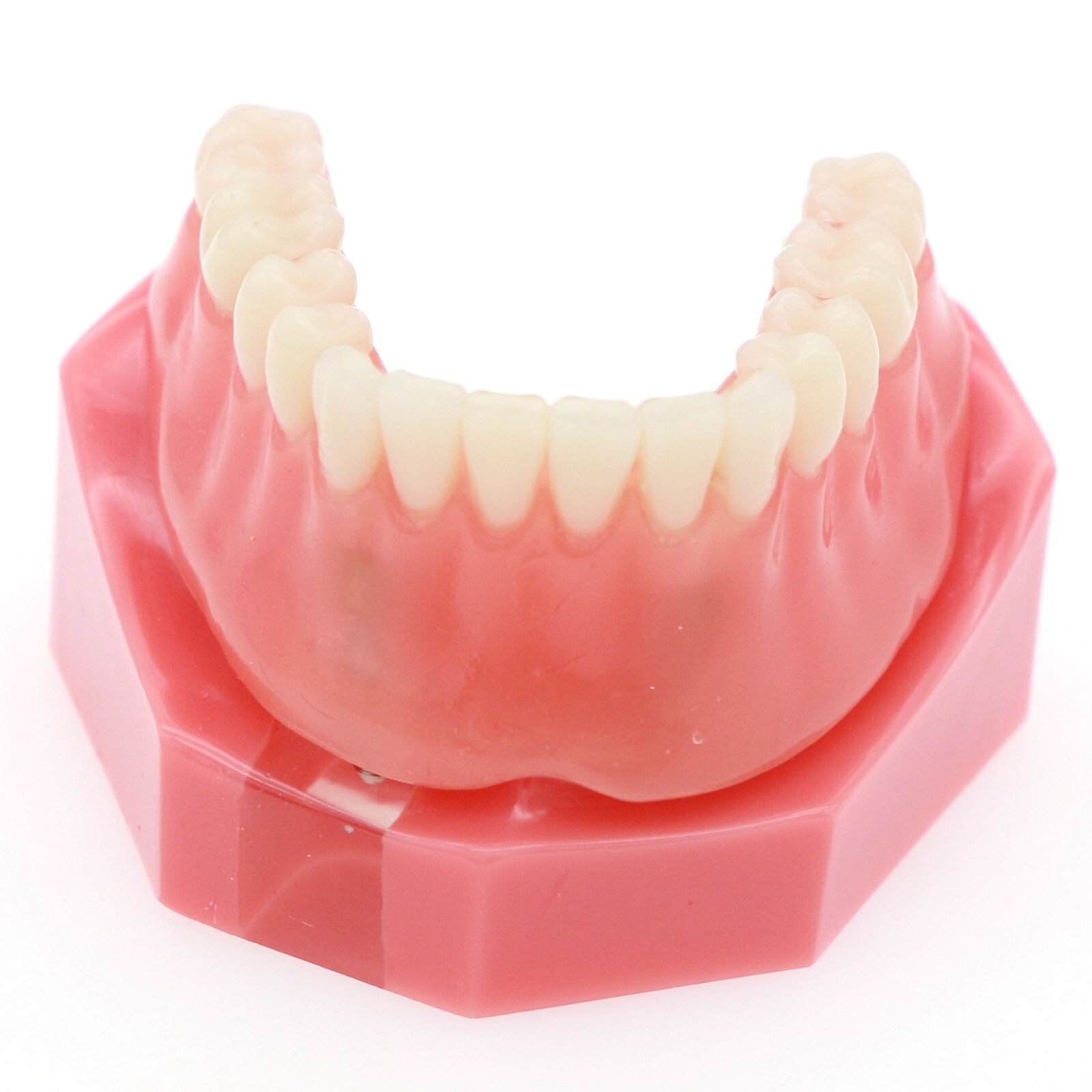 Dental Implant Typodont Teeth Restoration Model Series Overdenture Practice Demo