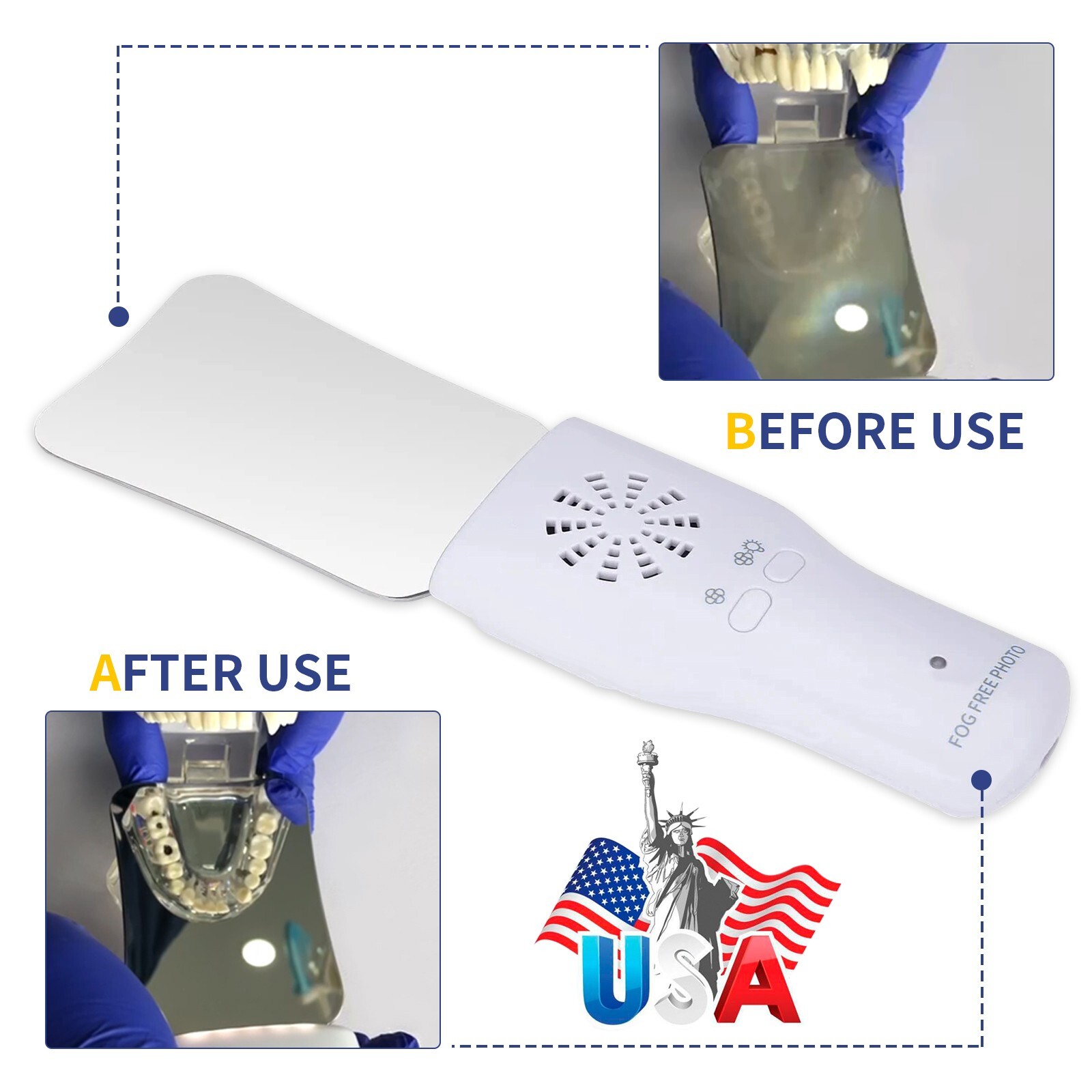 Dental Occlusal Mirror Fog Free LED Intra Oral Photo System Mirror Anti-Fog 4K