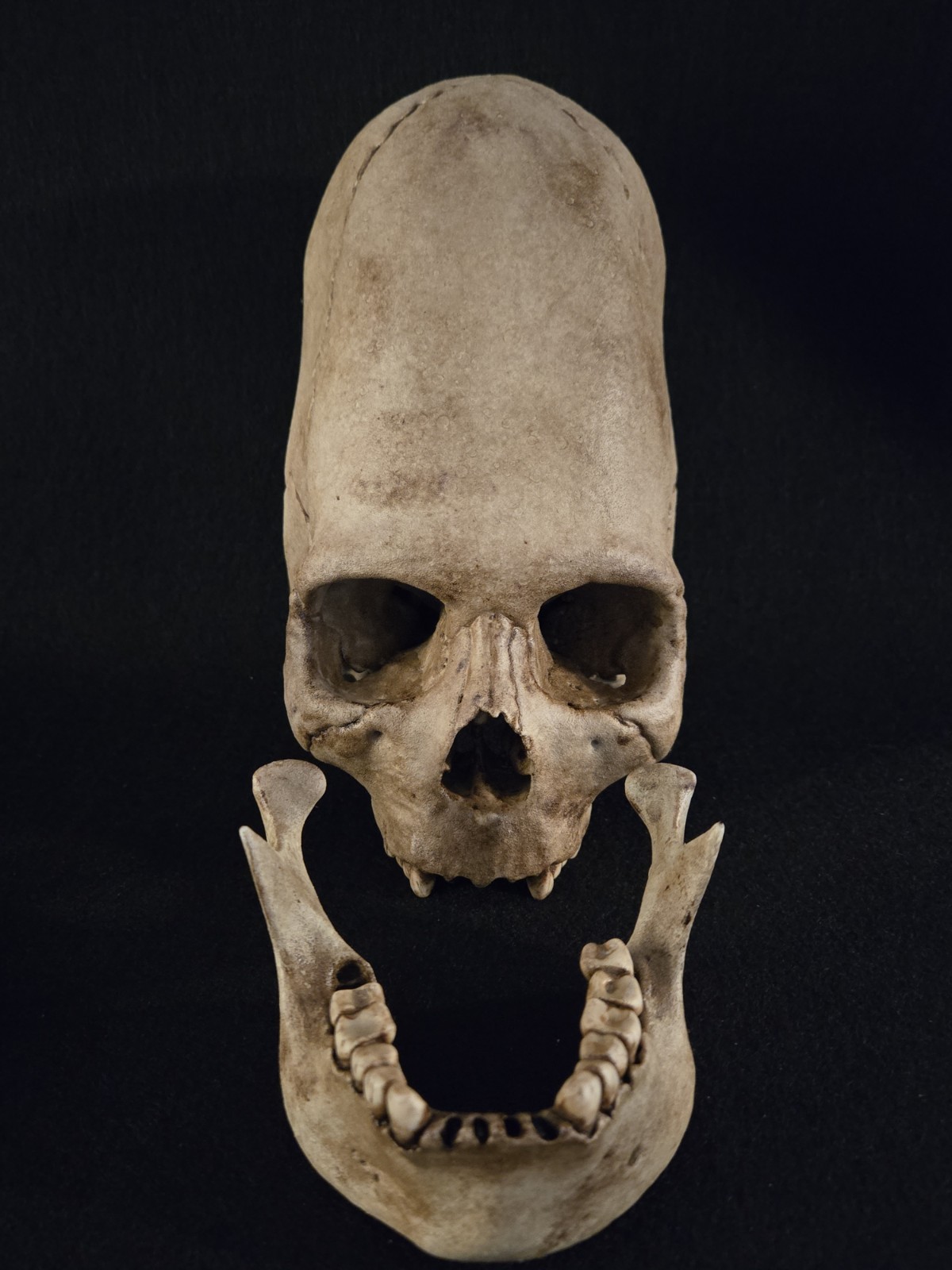 Human Skull - Peruvian Enlongated- Hyper Realistic with stand.